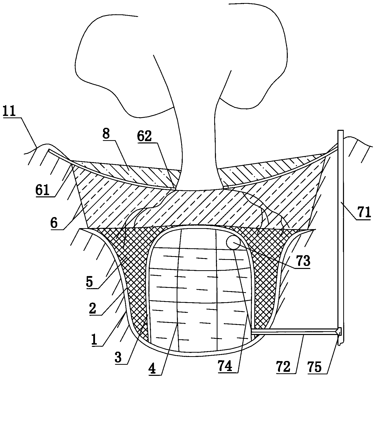 Water-storing bottom irrigation system for plants