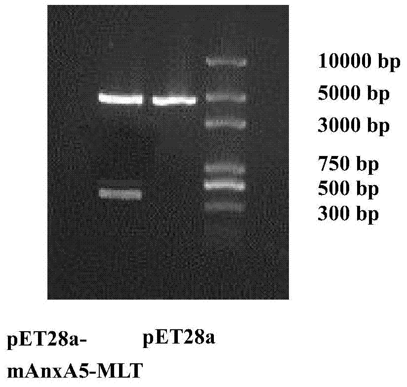 Targeting anti-tumor fusion protein, and encoding gene and expression plasmid thereof