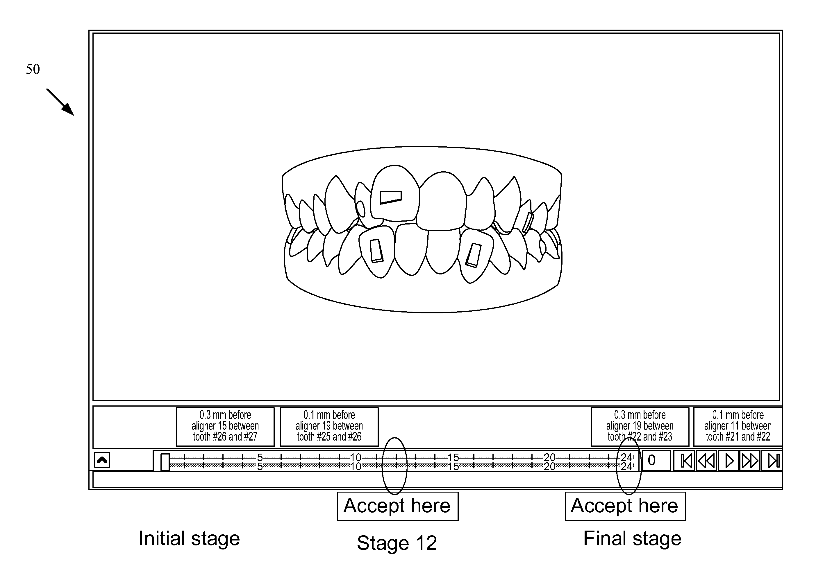 Comparative orthodontic treatment planning tool