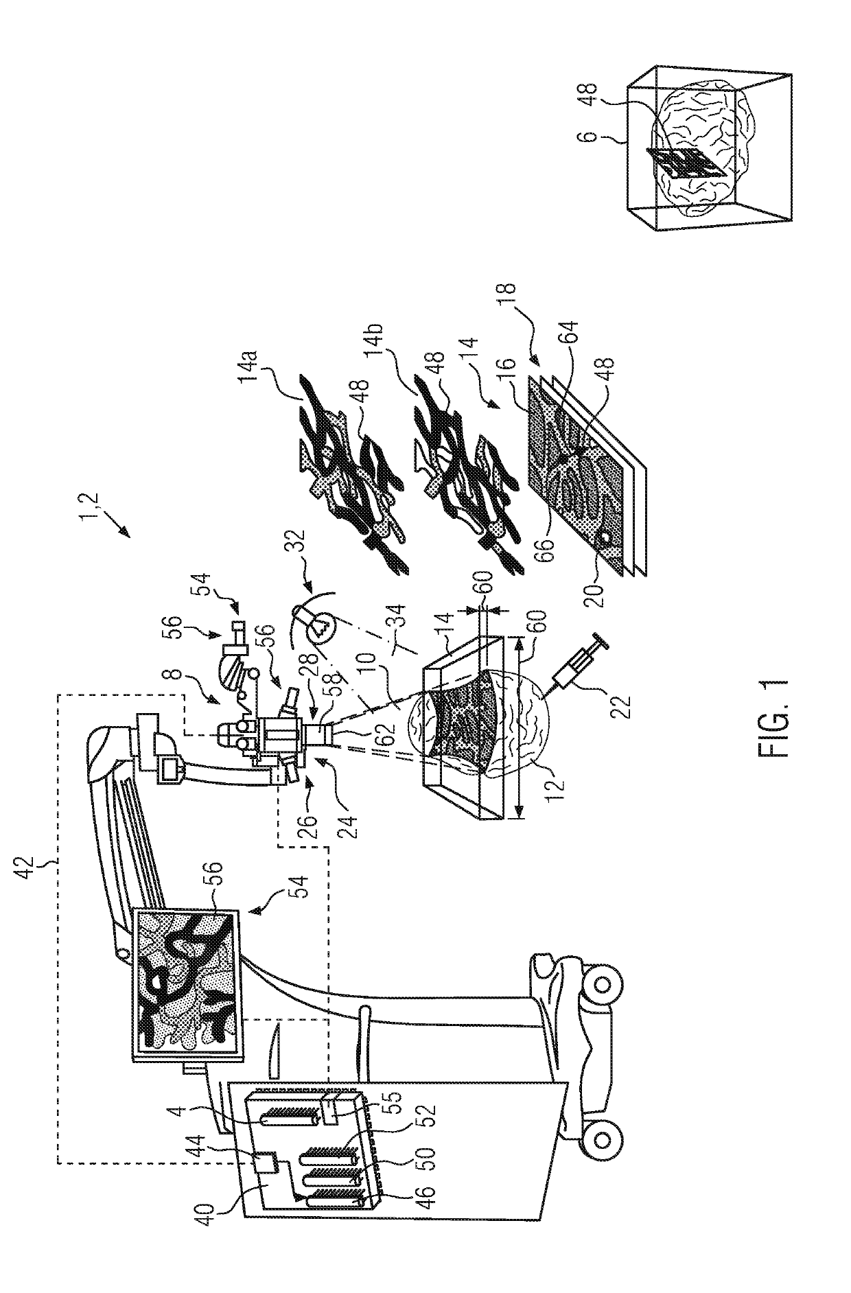 Image processing method and apparatus using elastic mapping of vascular plexus structures