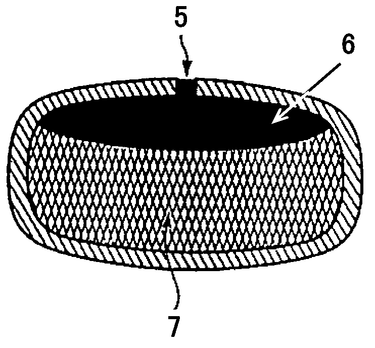 Phencynonate hydrochloride double-layer osmotic pump controlled release tablet and preparation method thereof