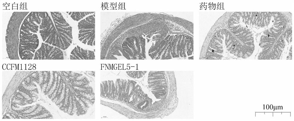 A strain of Lactobacillus rhamnosus capable of preventing and relieving ulcerative colitis and its application