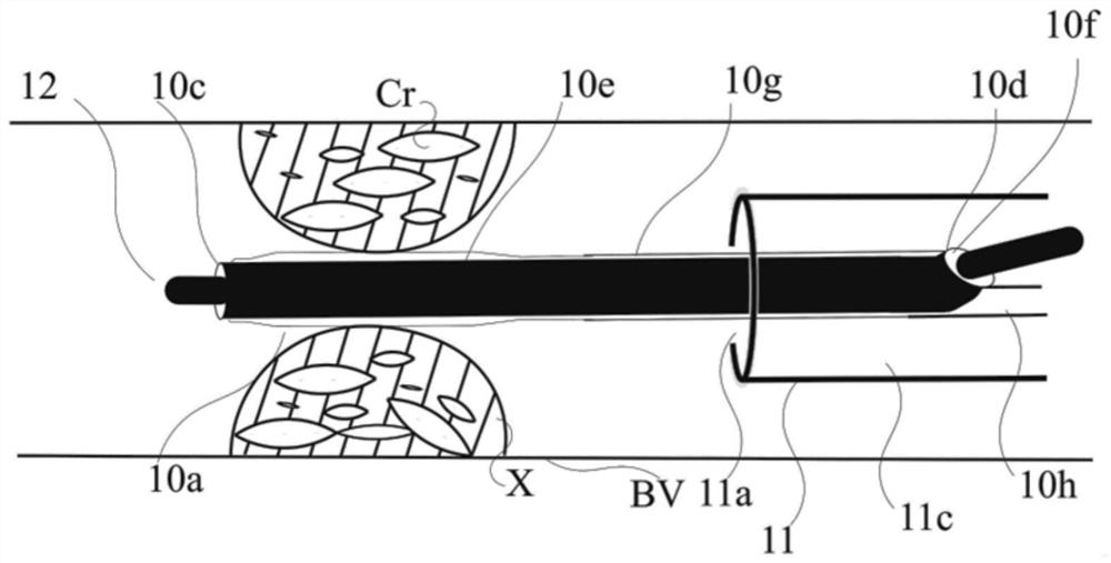 Treatment method, separation method, and filter assembly