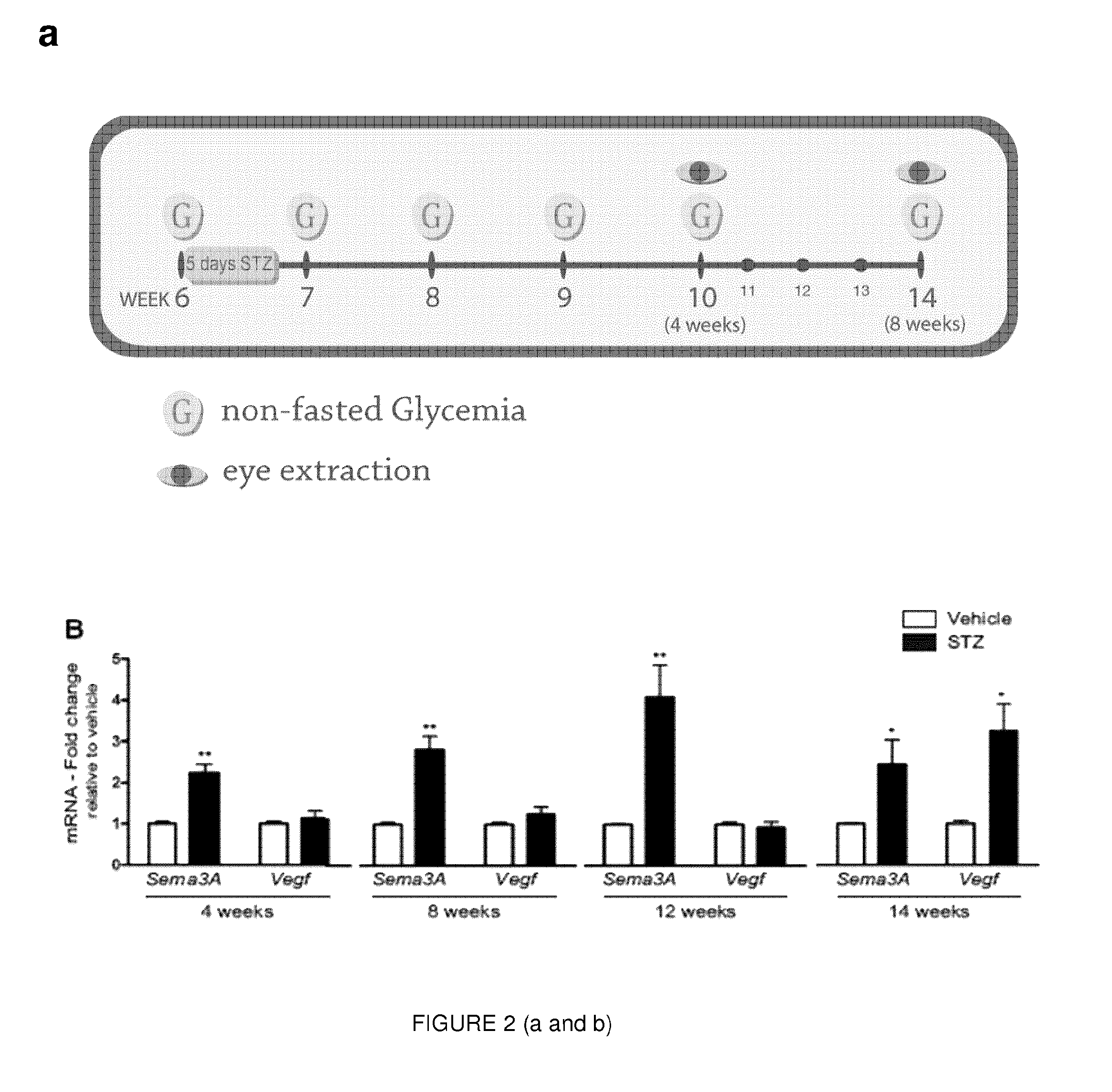 Inhibition of sema3a in the prevention and treatment of ocular hyperpermeability