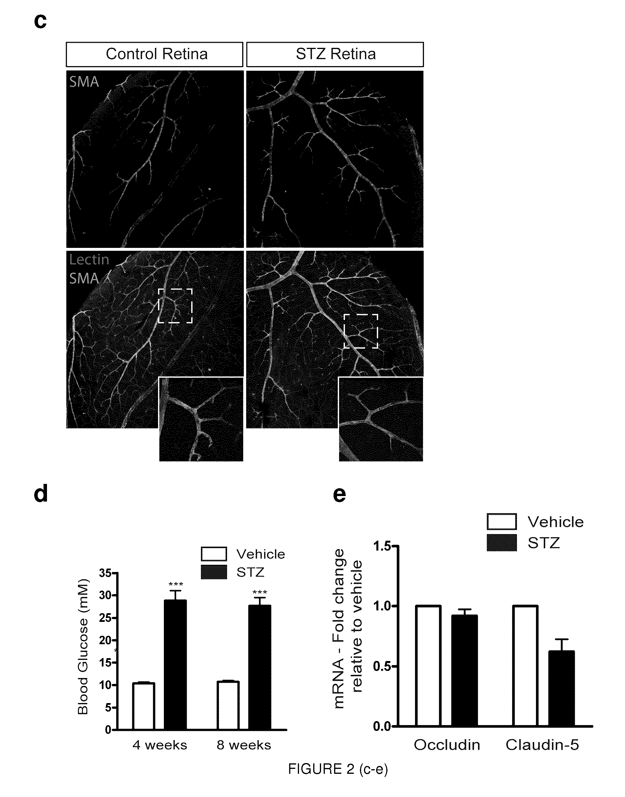 Inhibition of sema3a in the prevention and treatment of ocular hyperpermeability