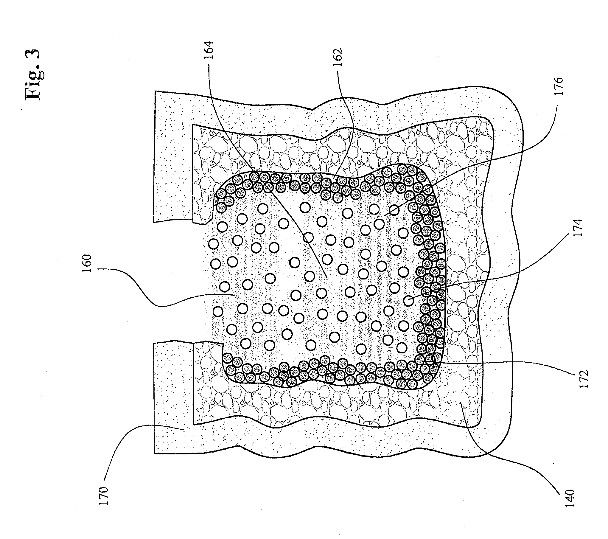 Bone cement composite containing particles in a non-uniform spatial distribution and devices for implementation