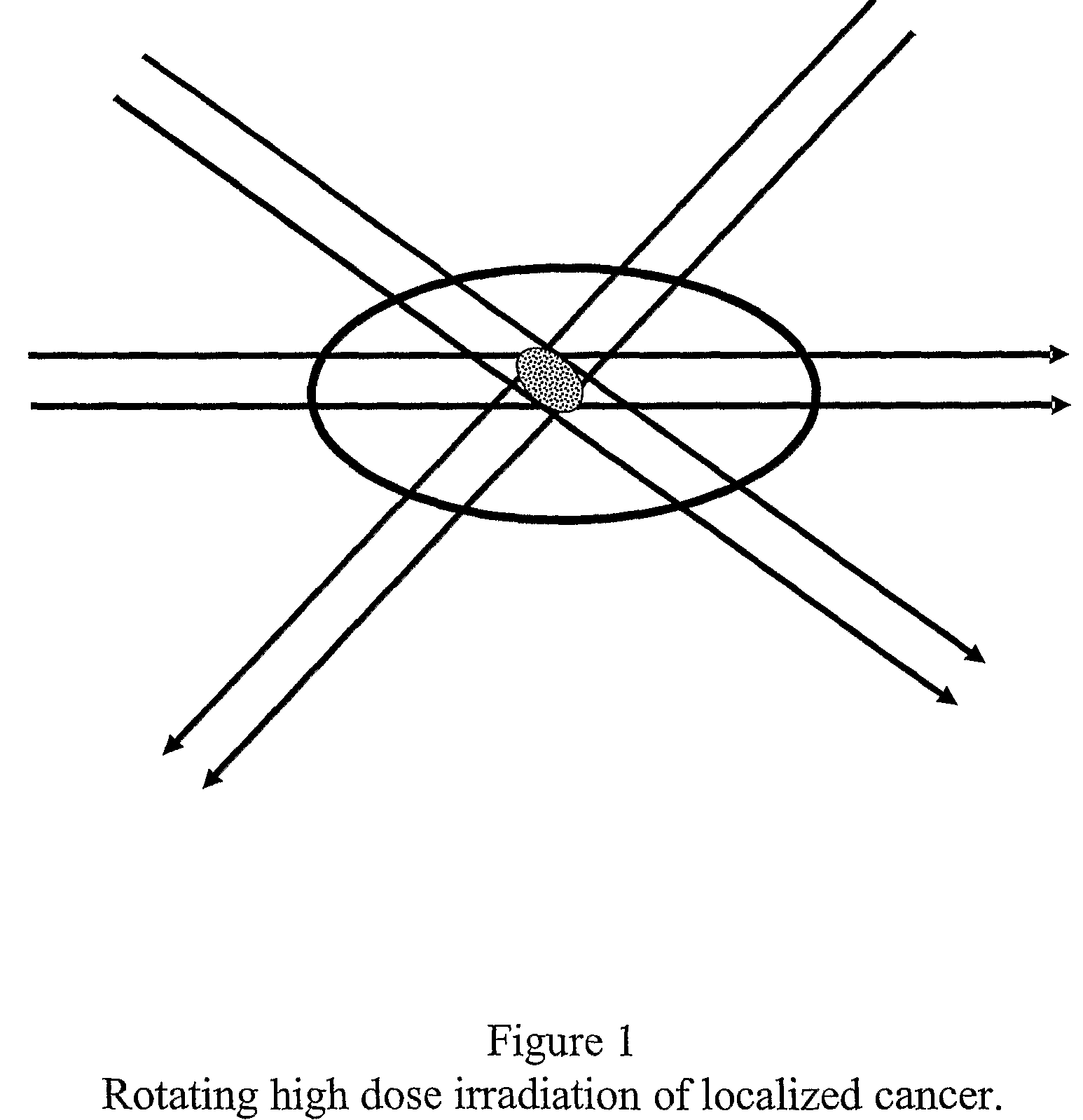 Computer prescribed treatment to reduced damage from radiation therapy and chemotherapy