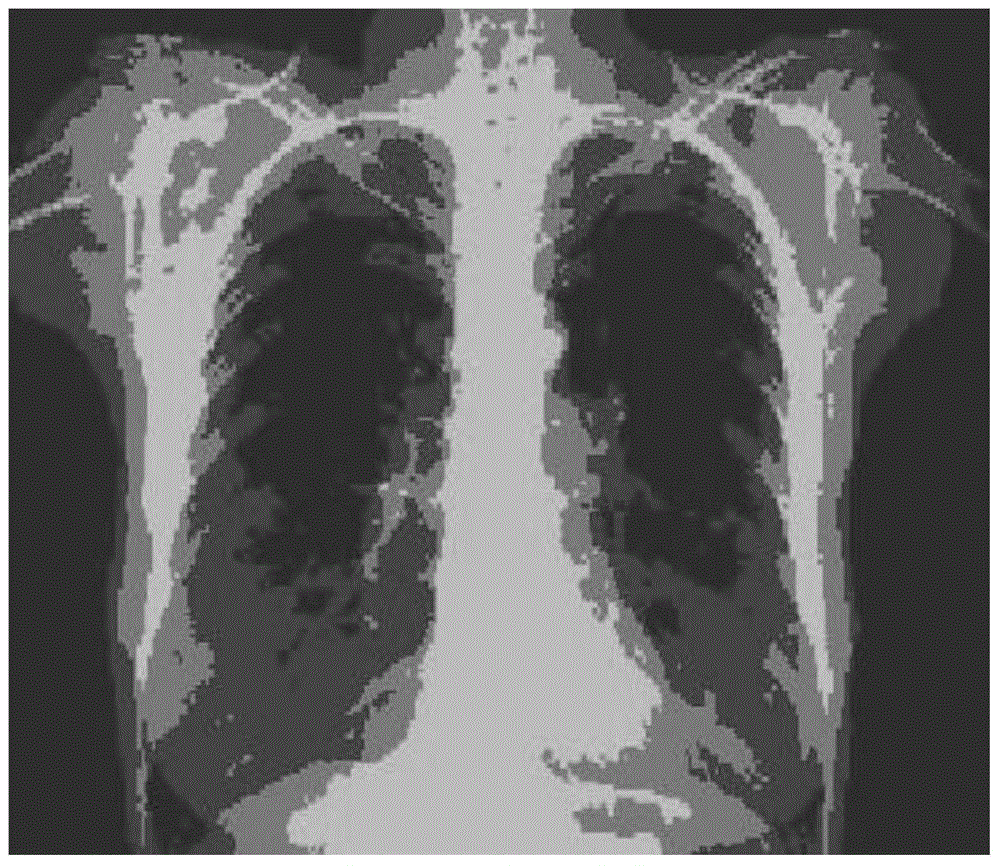 Clustering Ensemble Method for X-ray Image Data