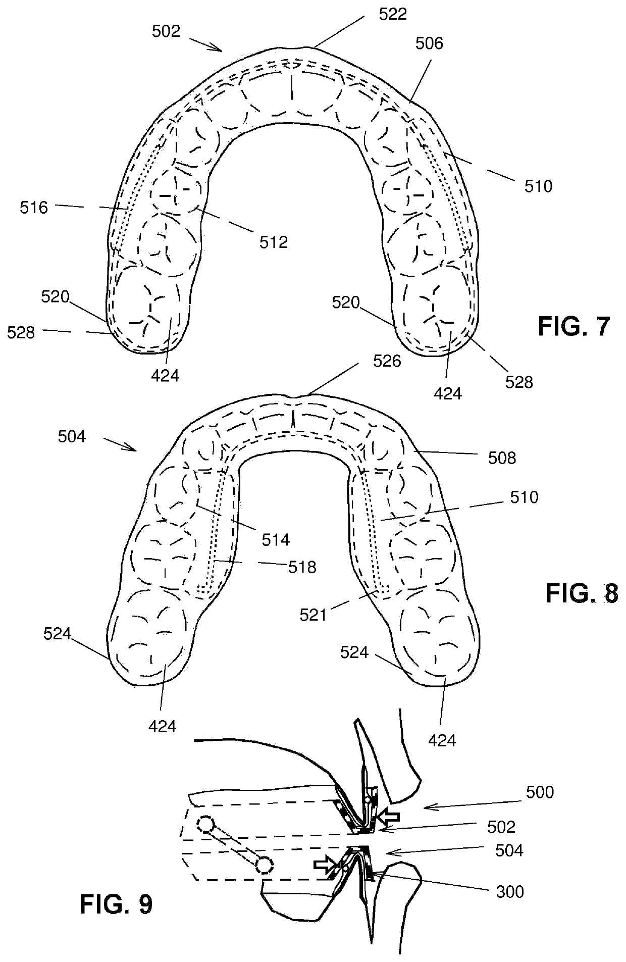 Intraoral device and method of using same