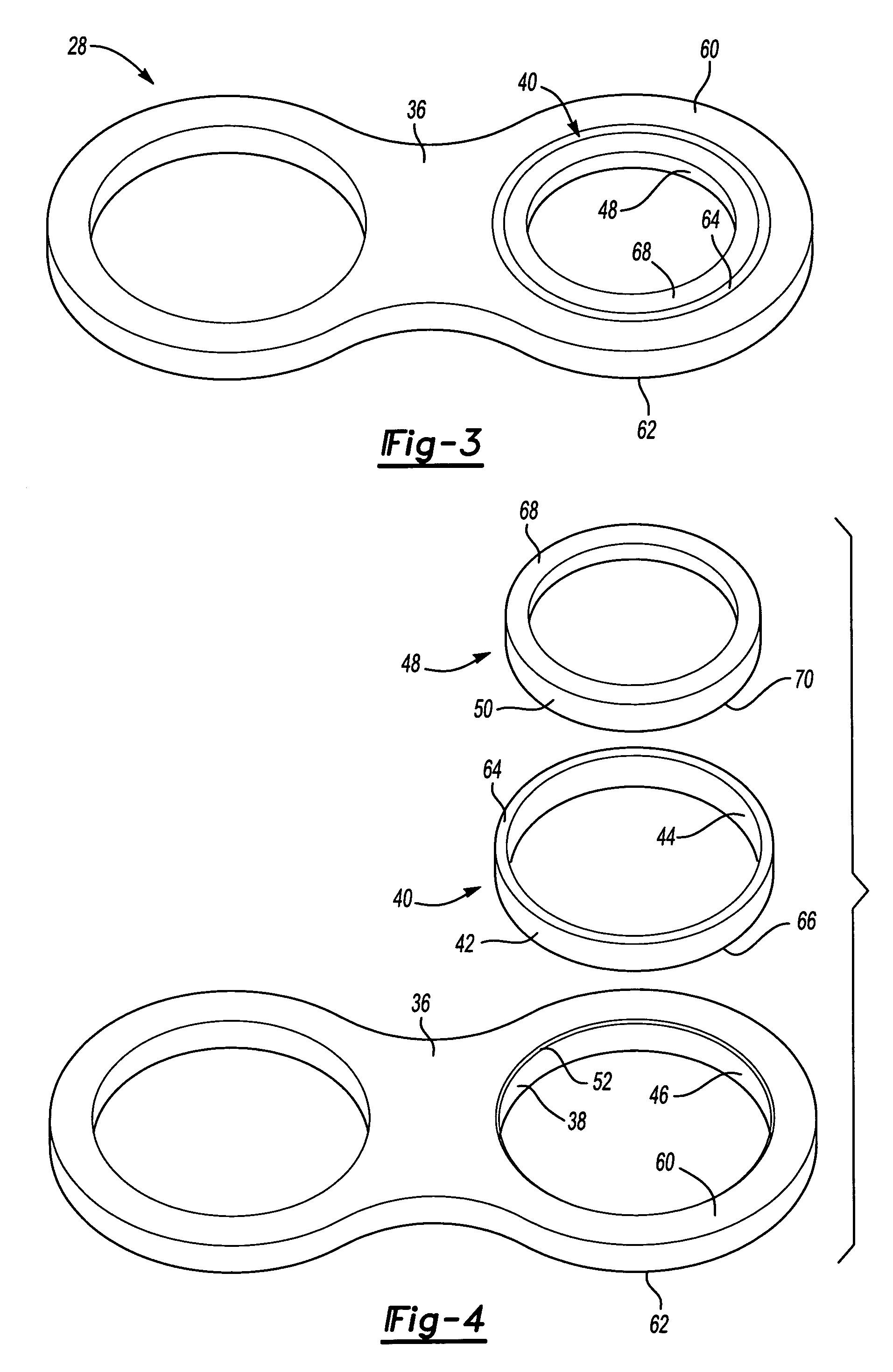 Engine mount bearing sleeve repair