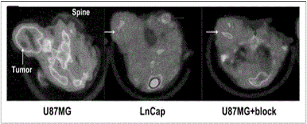 Radioactive C-MET-targeted affinity micromolecular compound and application thereof