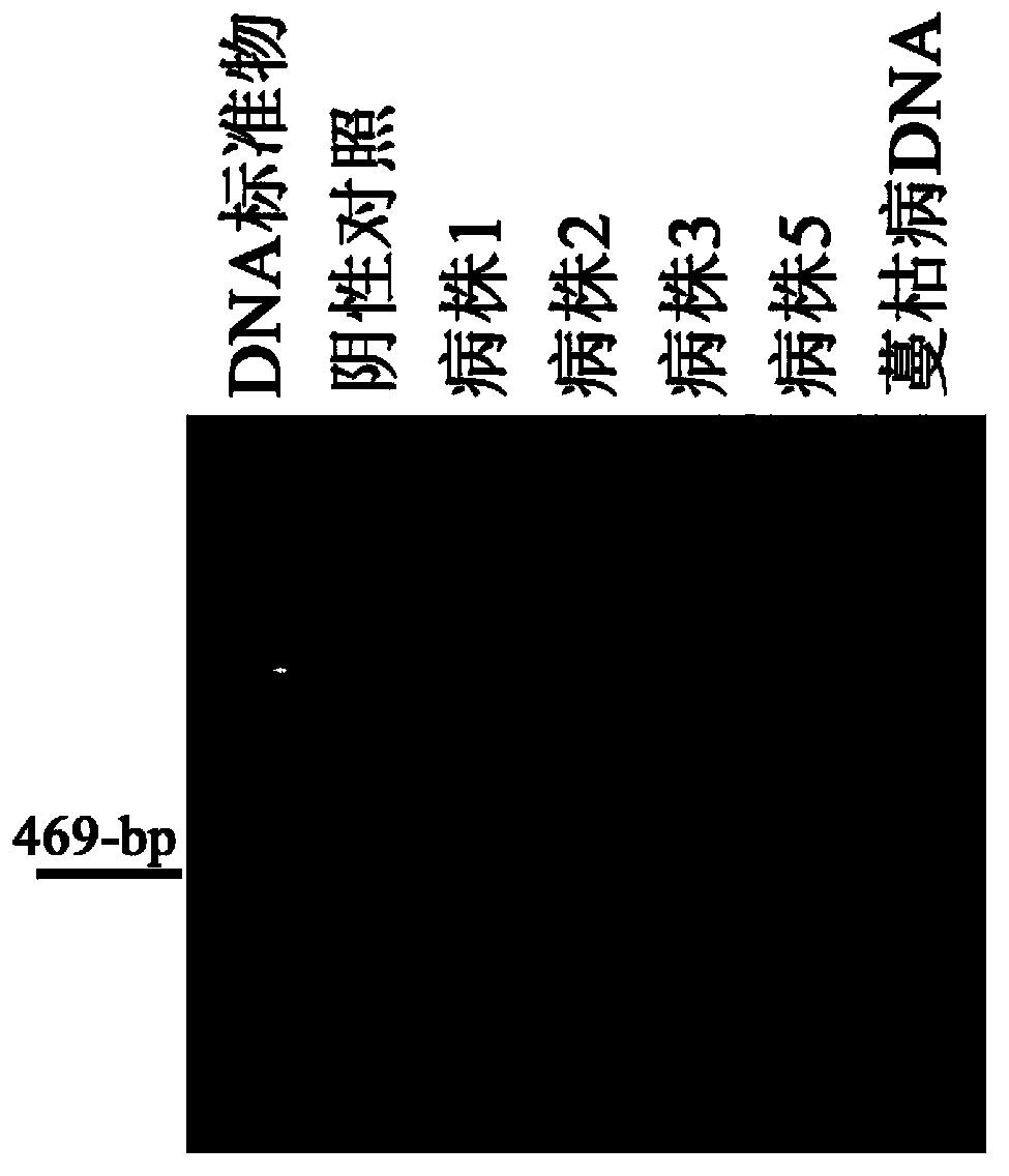 Specific primer and kit for detecting melon gummy stem blight