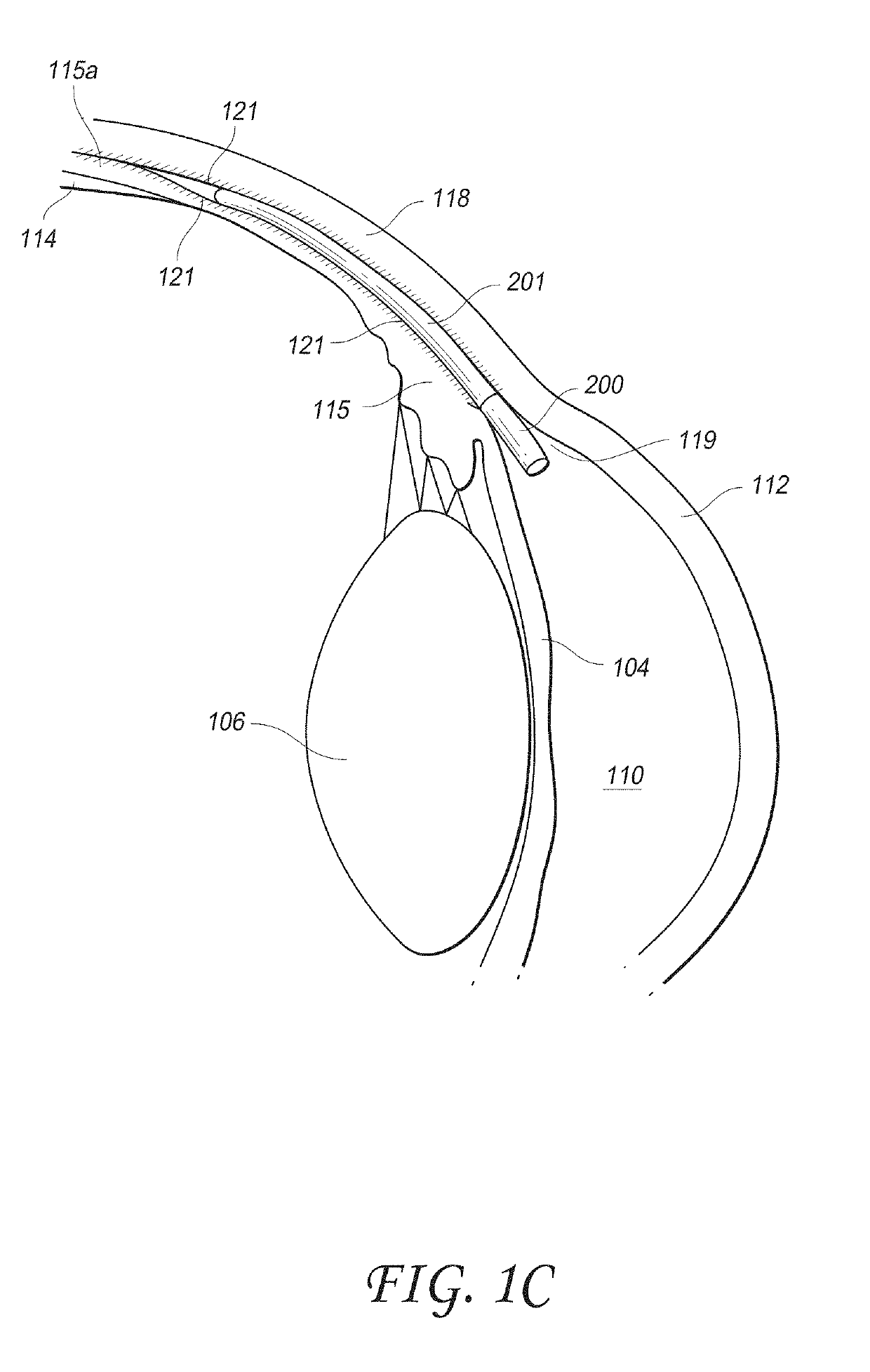 Intraocular physiological sensor