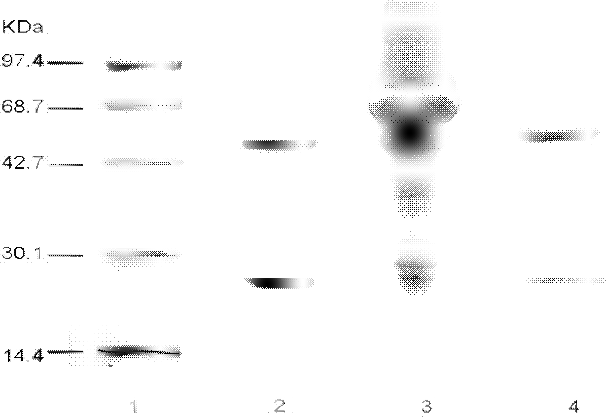 Sulfadimidine affinity membrane and application of sulfadimidine affinity membrane in antibody separation and purification