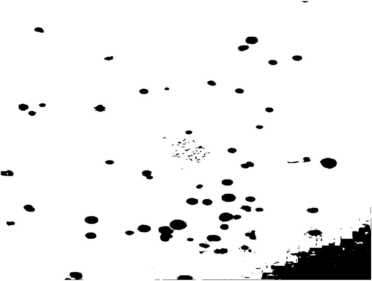 Preparation method of bone marrow chromosome G band