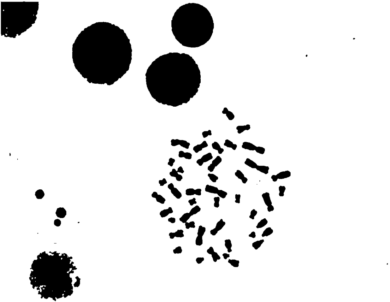 Preparation method of bone marrow chromosome G band