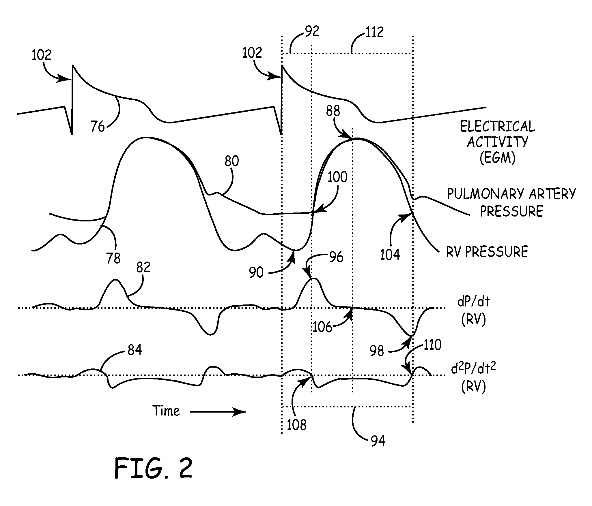 System and method for detecting artifactual hemodynamic waveform data