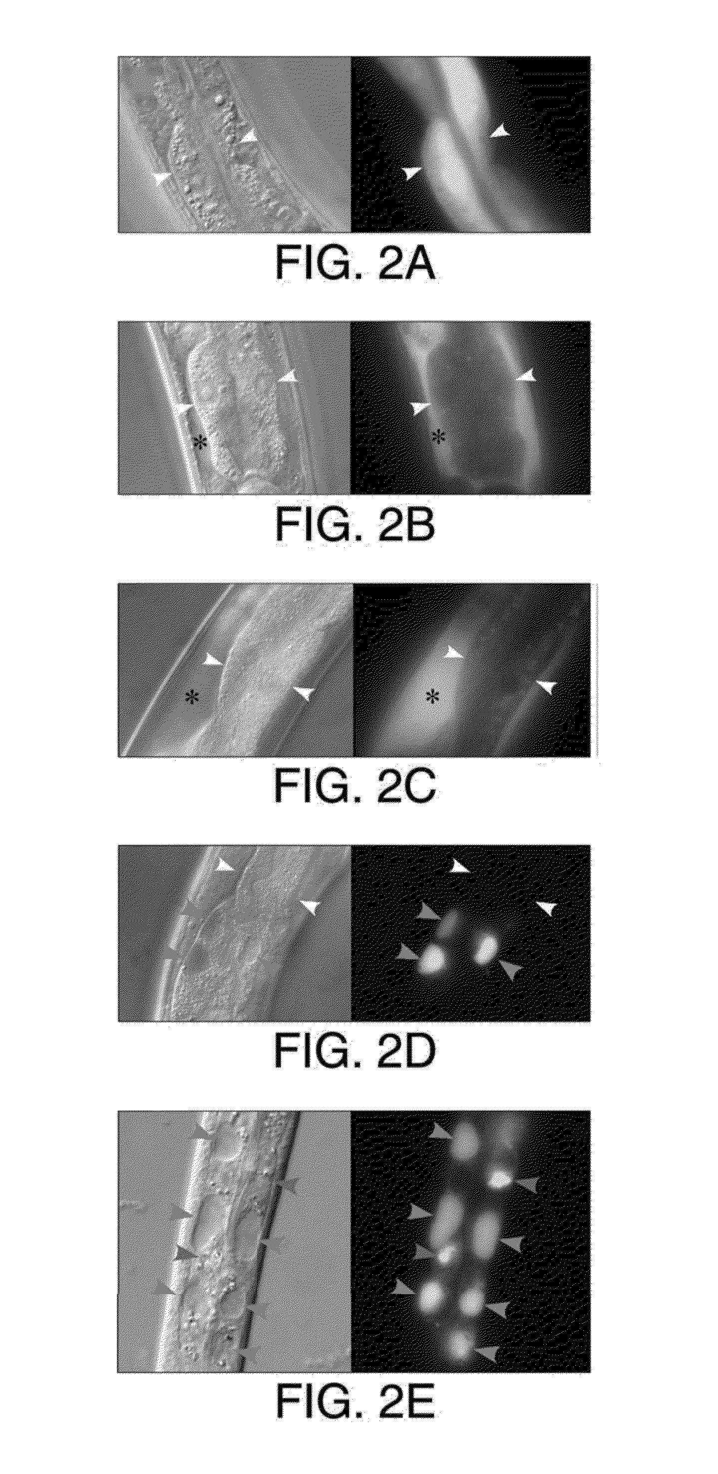 Automated high-content live animal drug screening using c. elegans