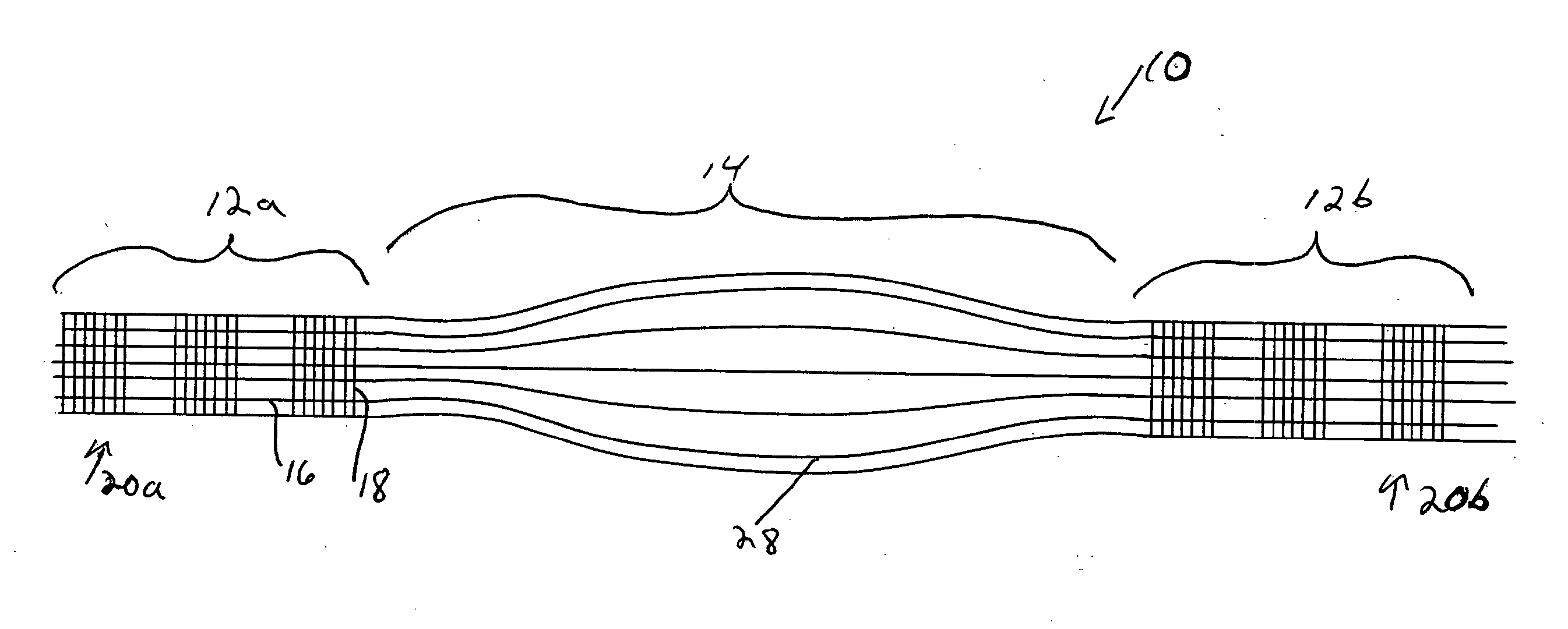 Scaffold for connective tissue repair