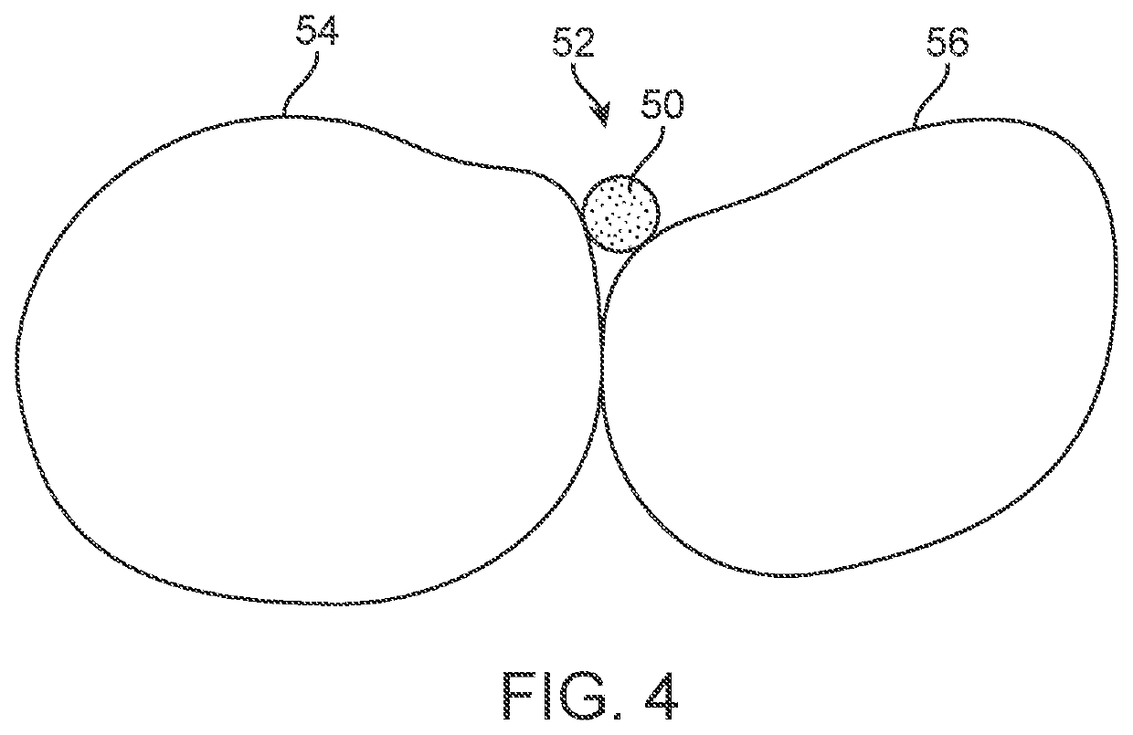 Three-dimensional printed dental appliances using support structures