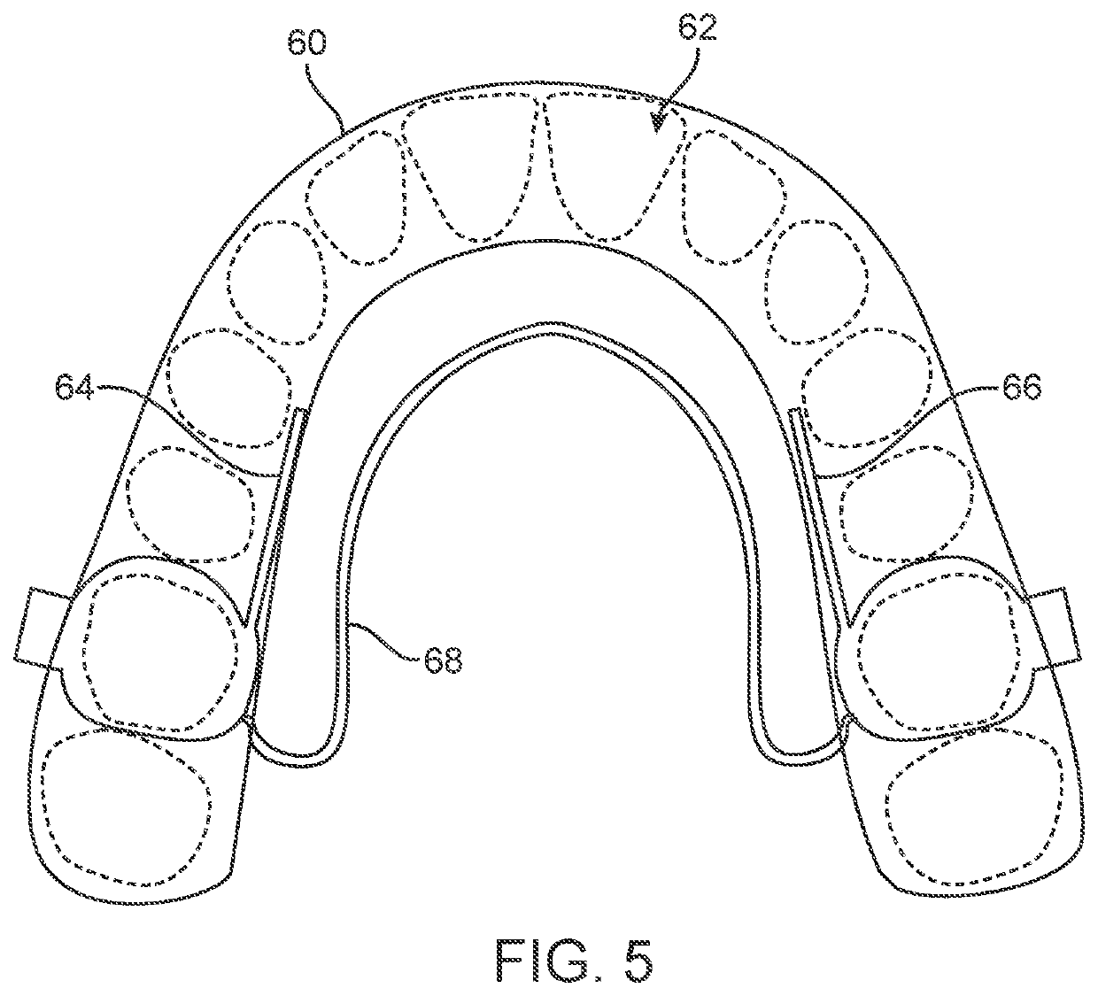 Three-dimensional printed dental appliances using support structures