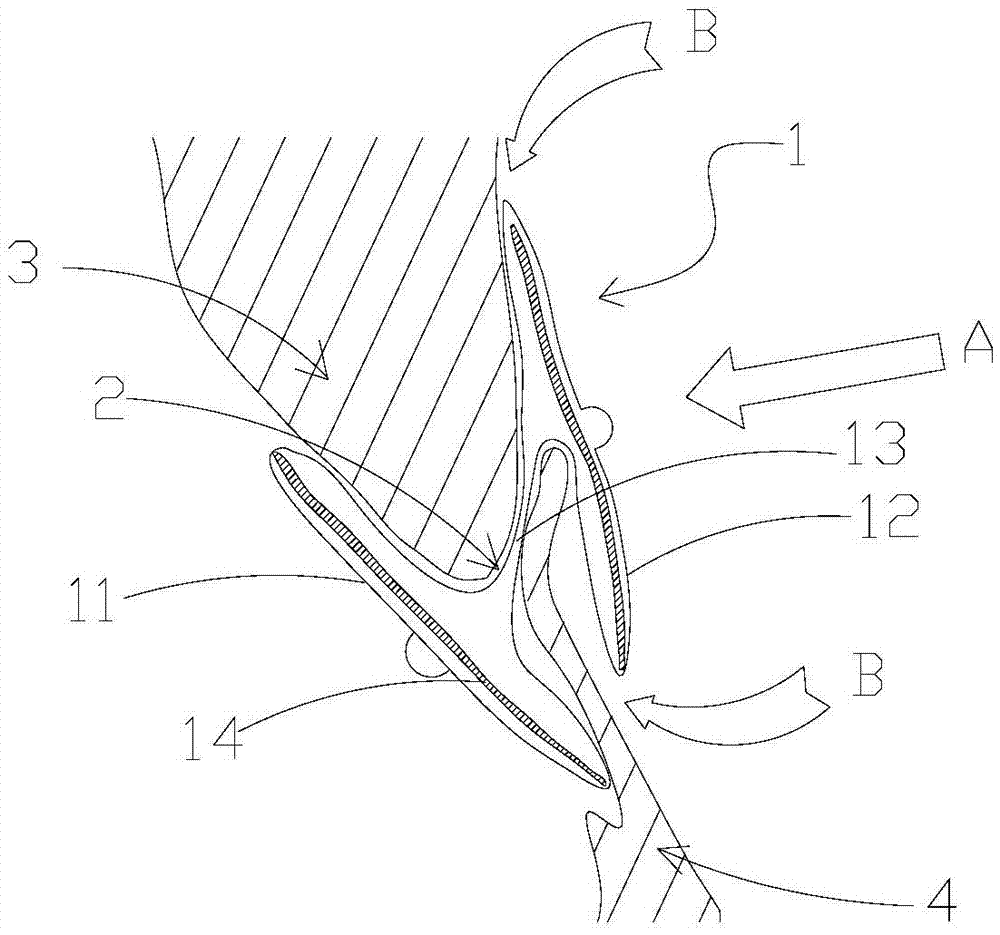 Closure device