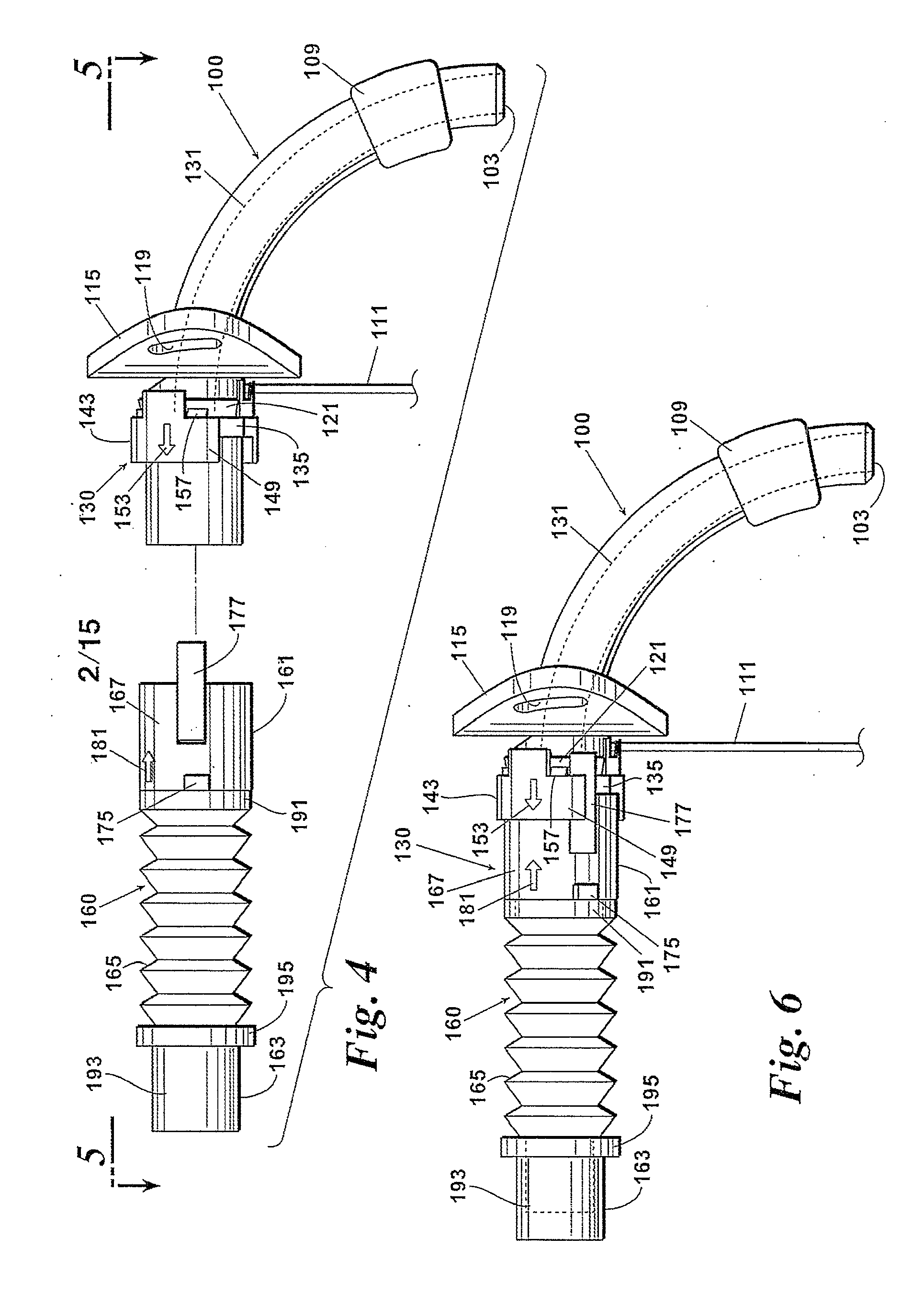 Ventilator to Tracheotomy Tube Coupling