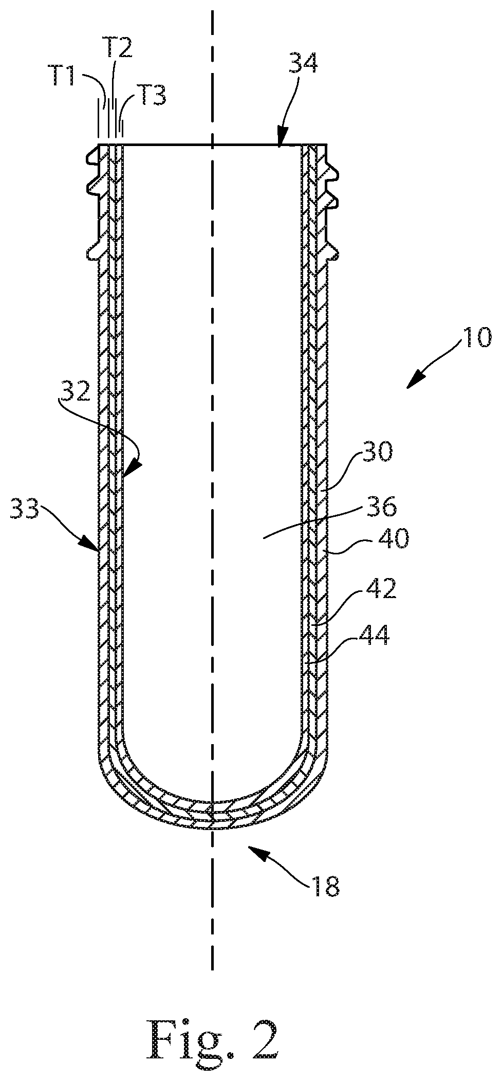 Mono-layer blow molded article with functional, visual, and/or tactile effects and method of making such articles