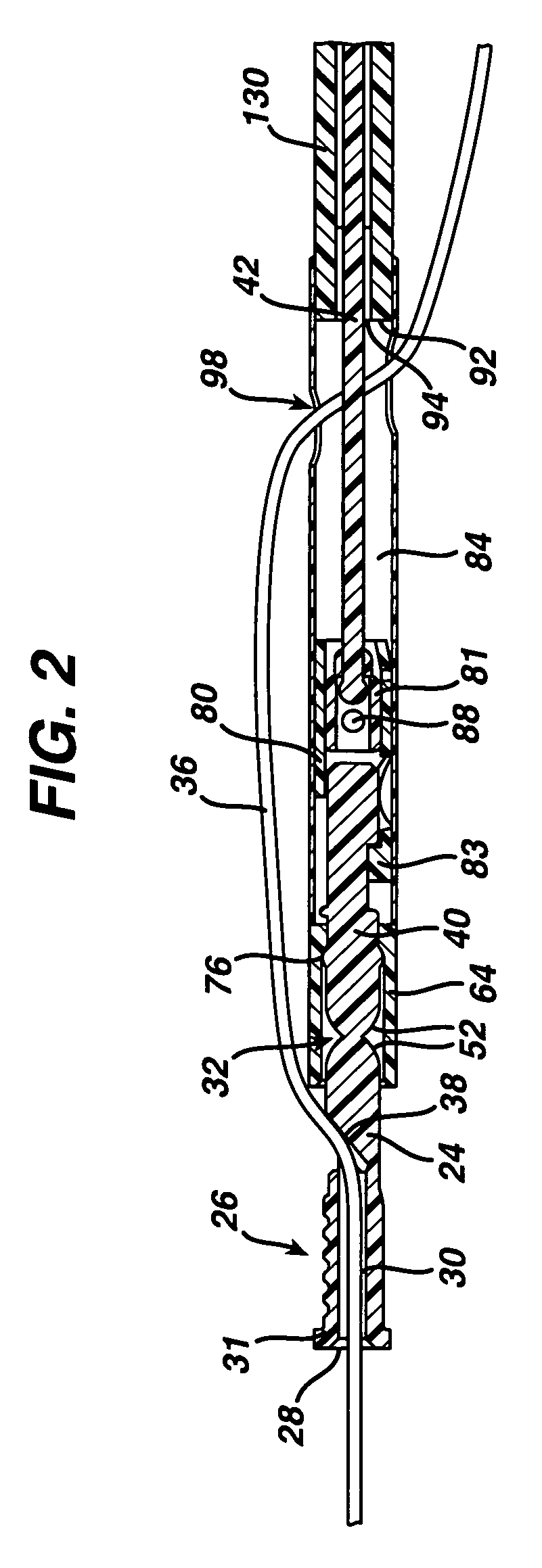 Suture locking device