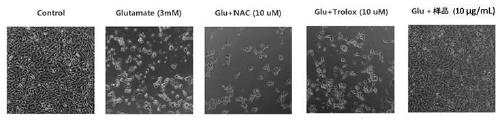 Application of Xiaobagu Extract as Neuroprotective Agent