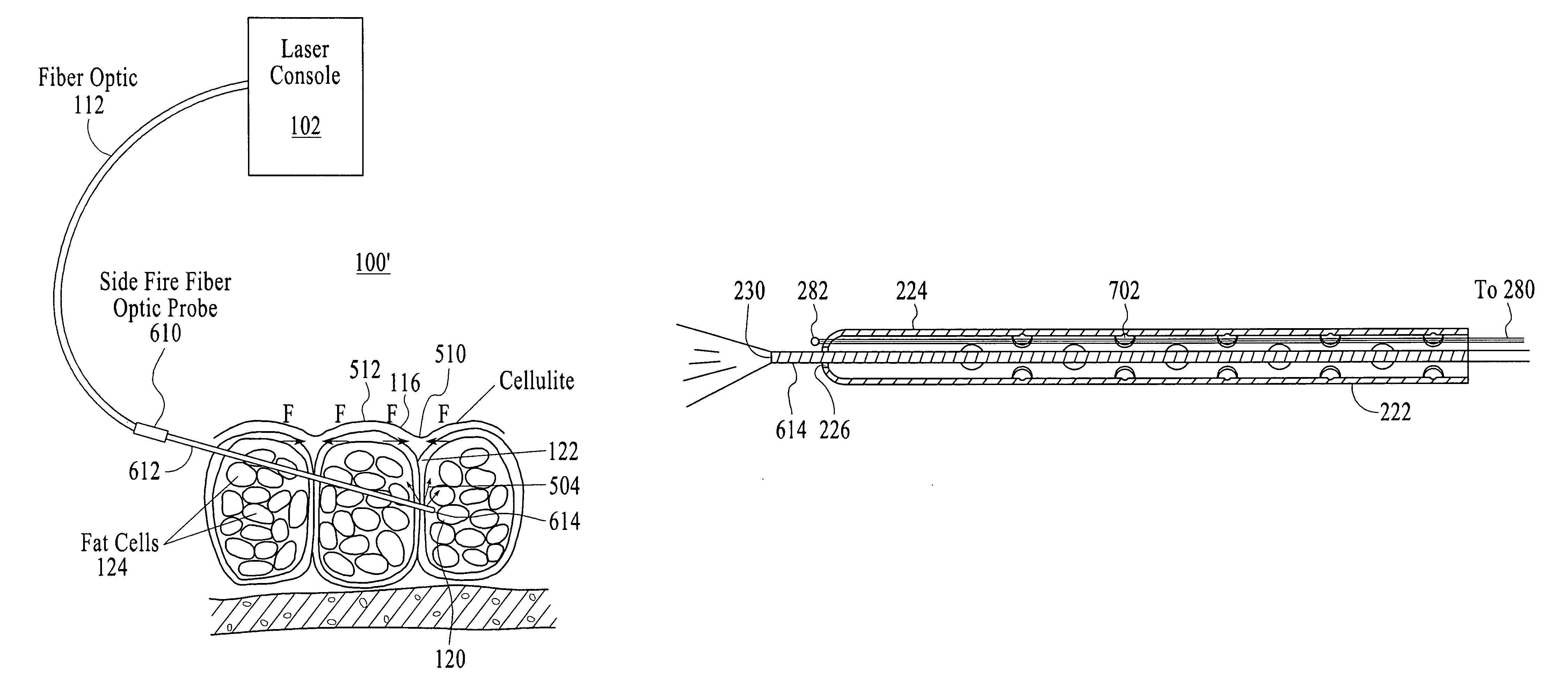 Treatment of cellulite and adipose tissue with mid-infrared radiation