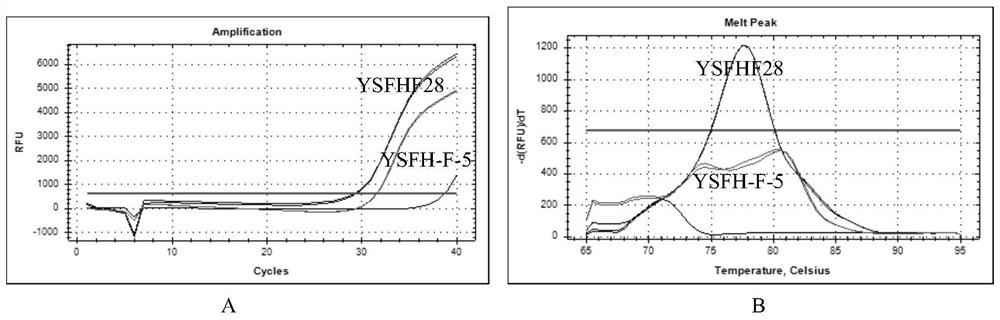 Kit for detecting Hantaan-type hantavirus and detection method thereof