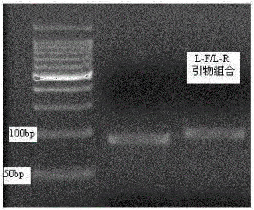 Detecting kit for severe fever with thrombocytopenia syndrome viruses (SFTSV) and preparation method of detecting kit