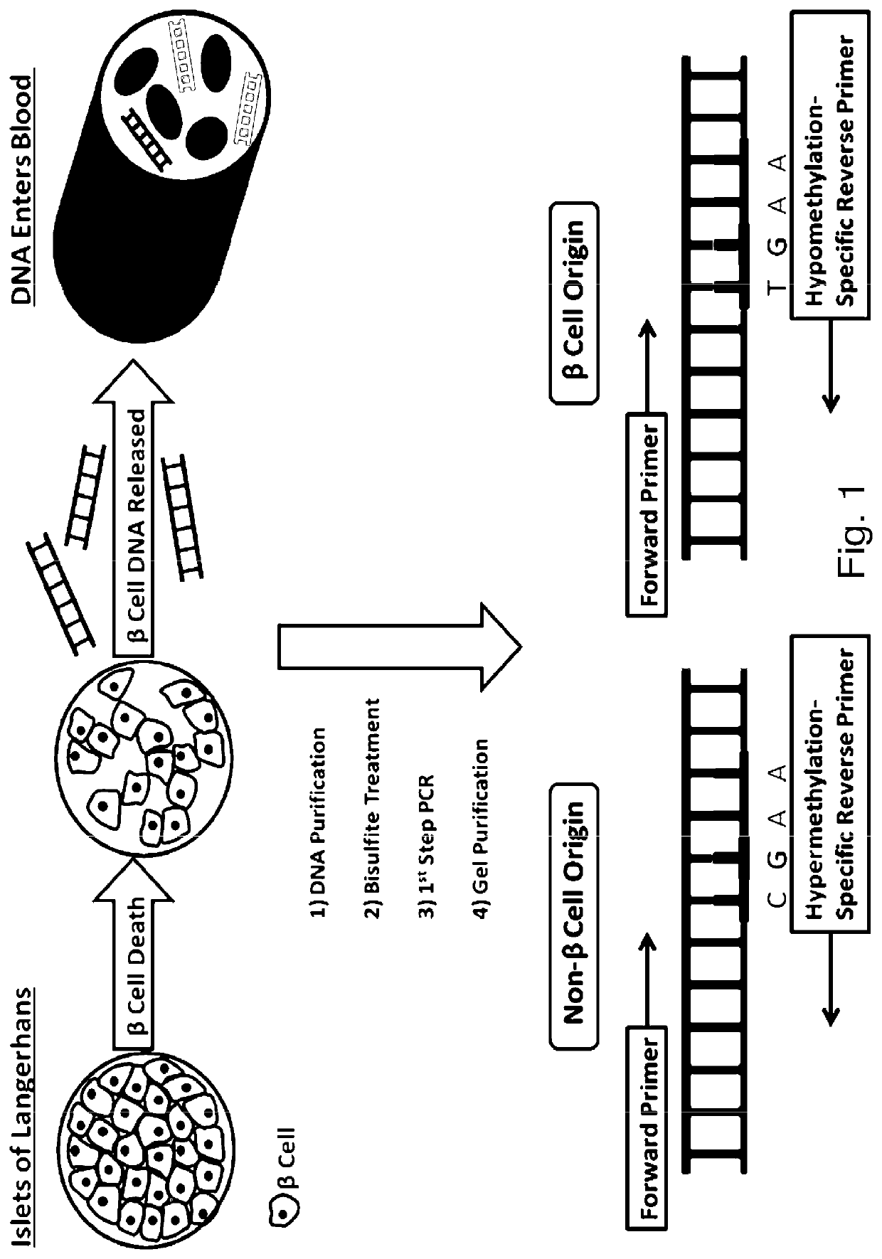 System, method and kit for analysis of circulating differentially methylated DNA as a biomarker of beta-cell loss