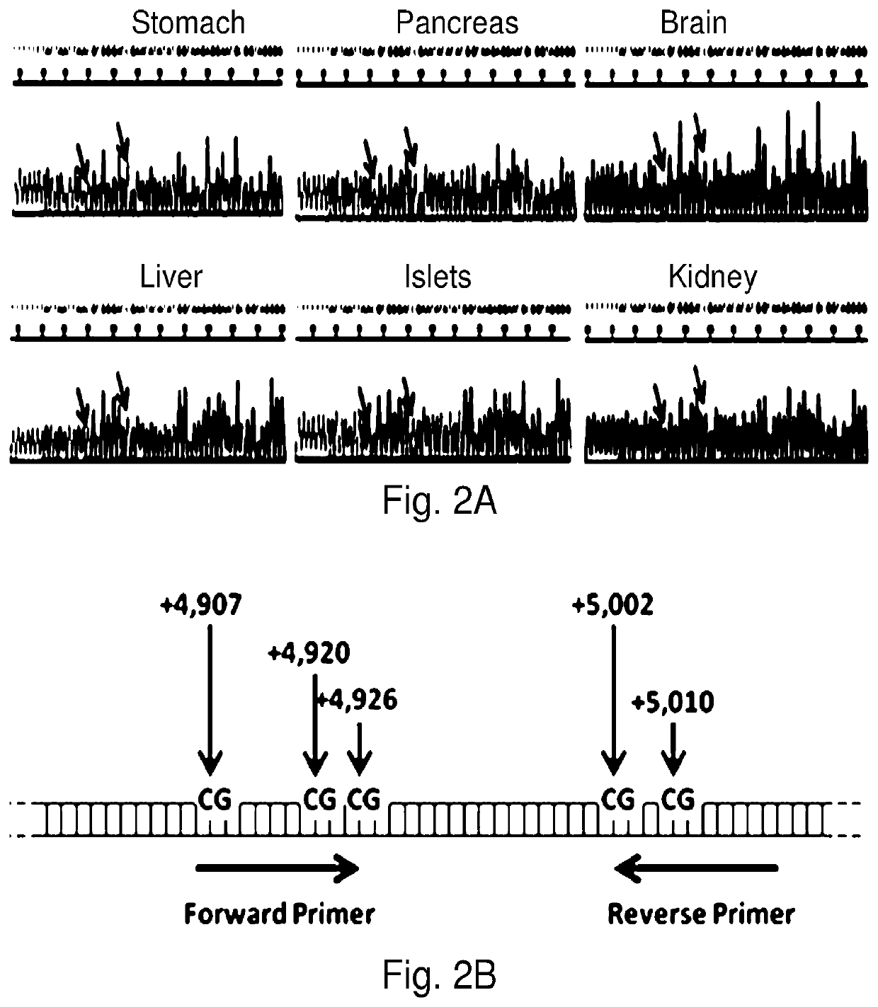 System, method and kit for analysis of circulating differentially methylated DNA as a biomarker of beta-cell loss