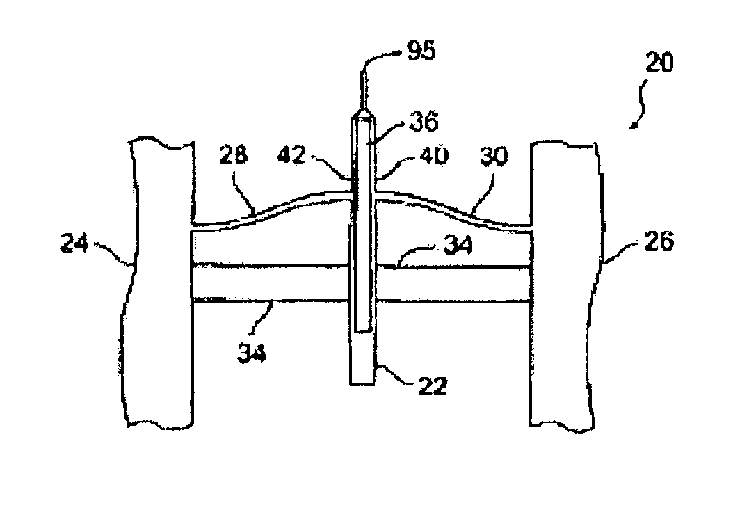 Drive circuit for a MEMS device