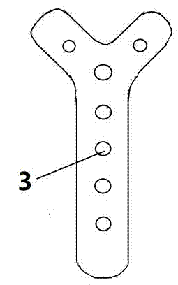 Tibia bone fracture plate of medical equipment for orthopedic surgery