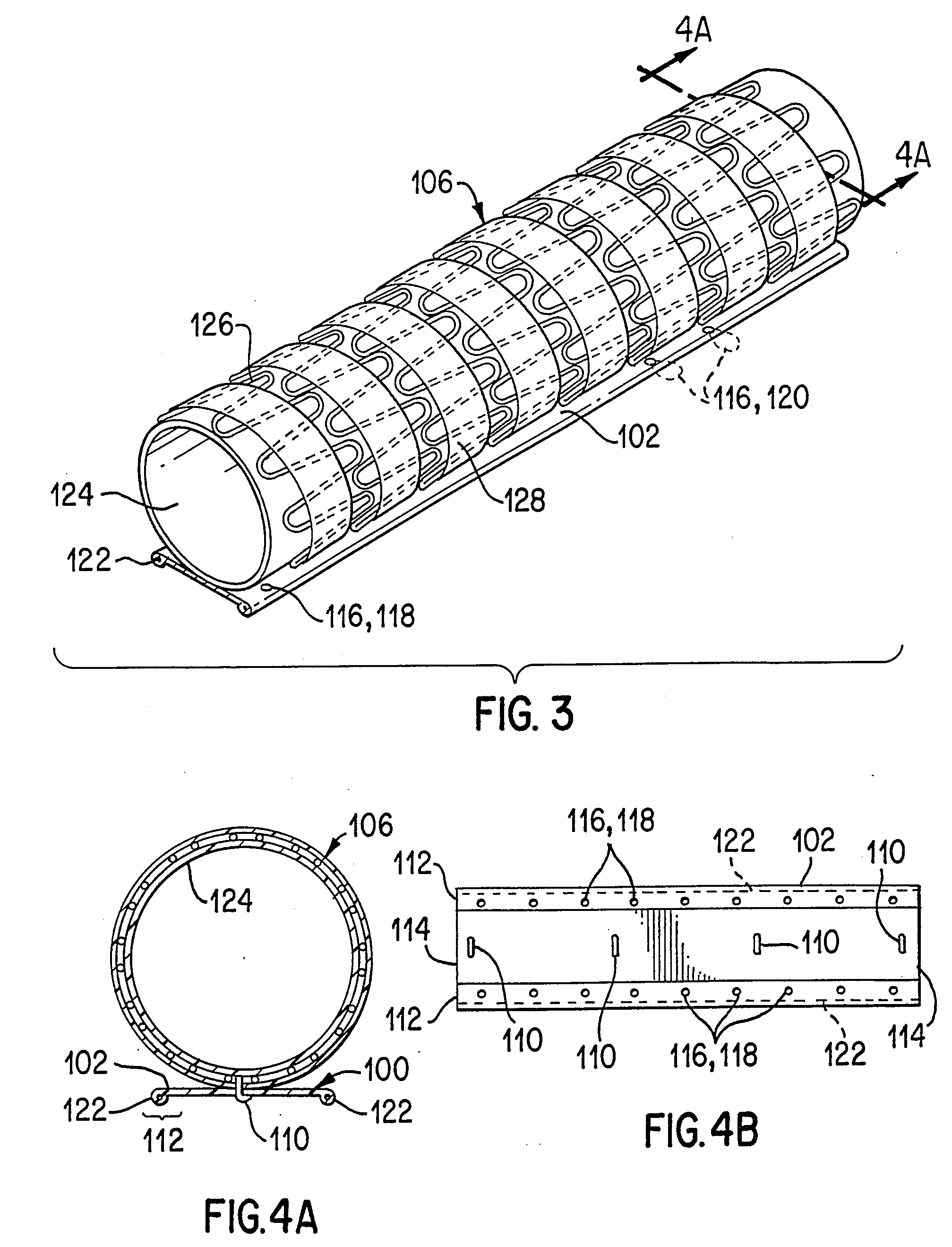 Implant Deployment Apparatus