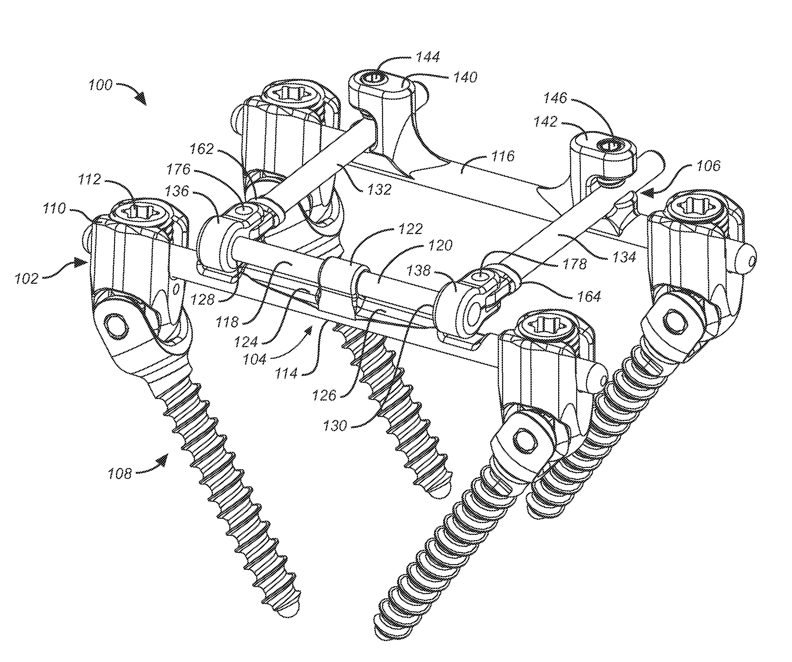 Implantation method for a dynamic stabilization and motion preservation spinal implantation system and method