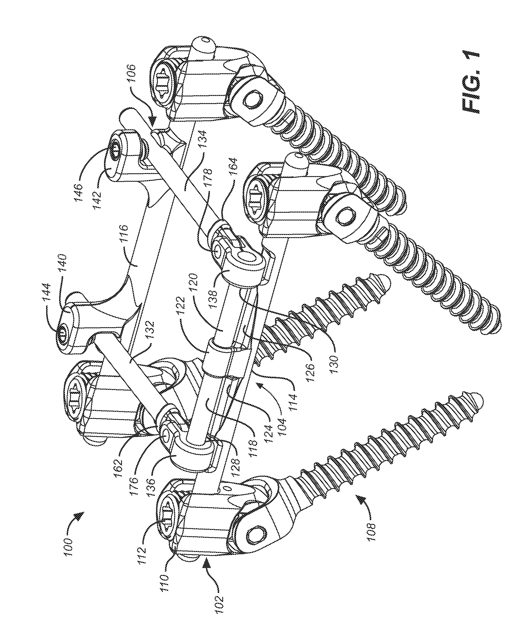 Implantation method for a dynamic stabilization and motion preservation spinal implantation system and method