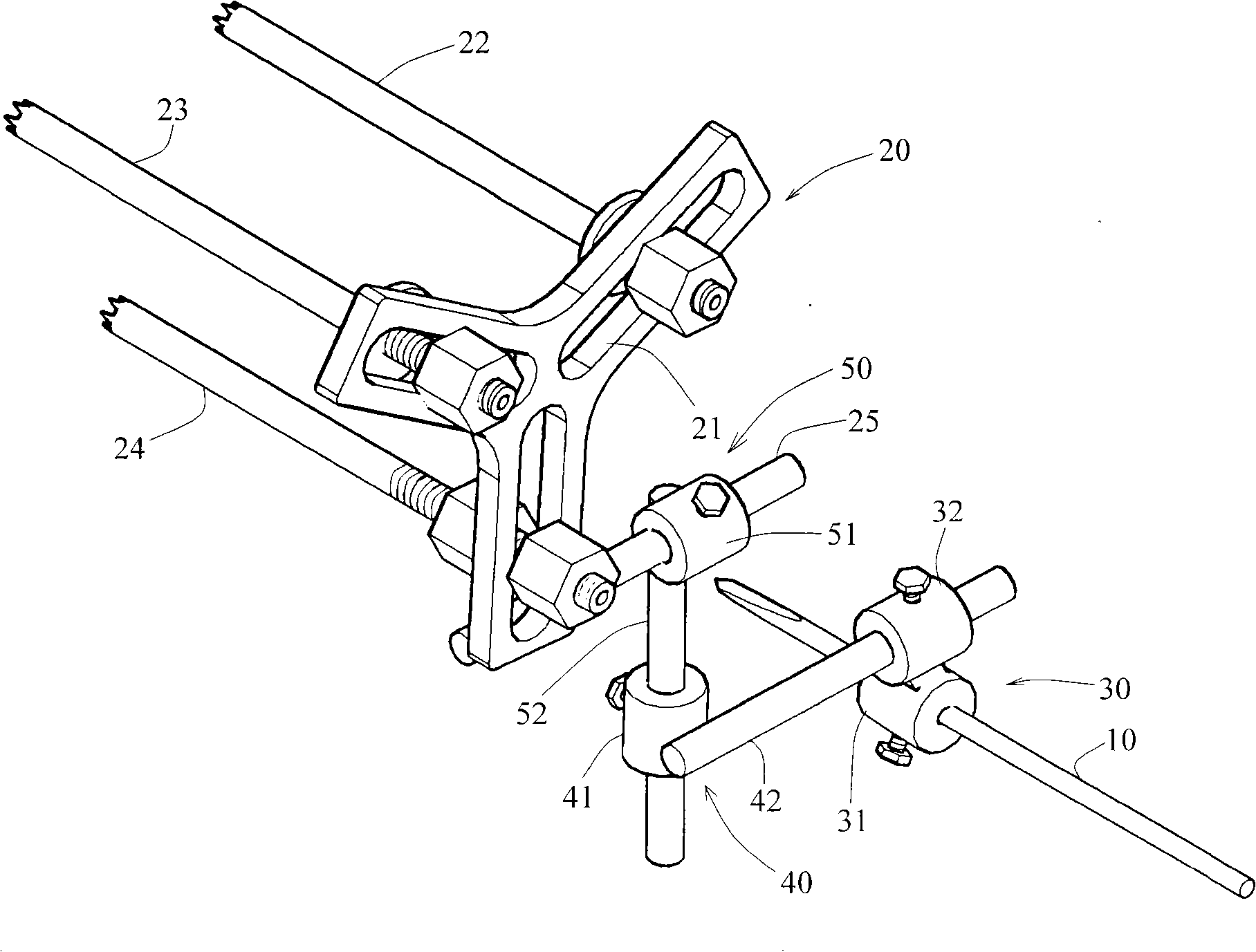 Hollow screw internal fixation guide pin locater of femoral neck fracture