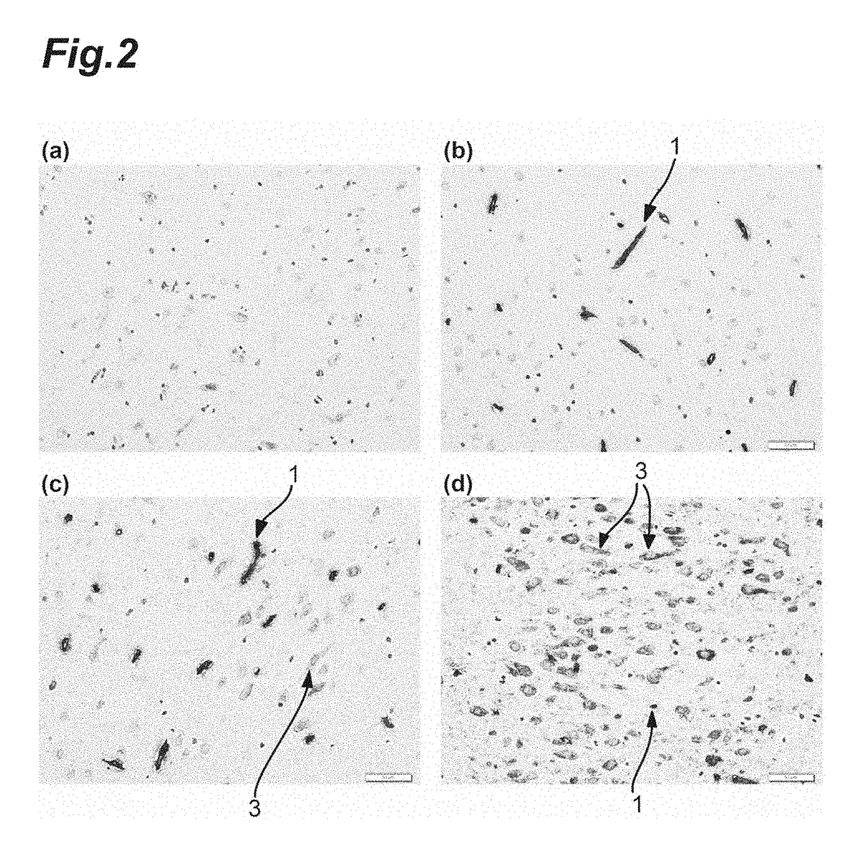 Anti-Human Transferrin Receptor Antibody Permeating Blood-Brain Barrier