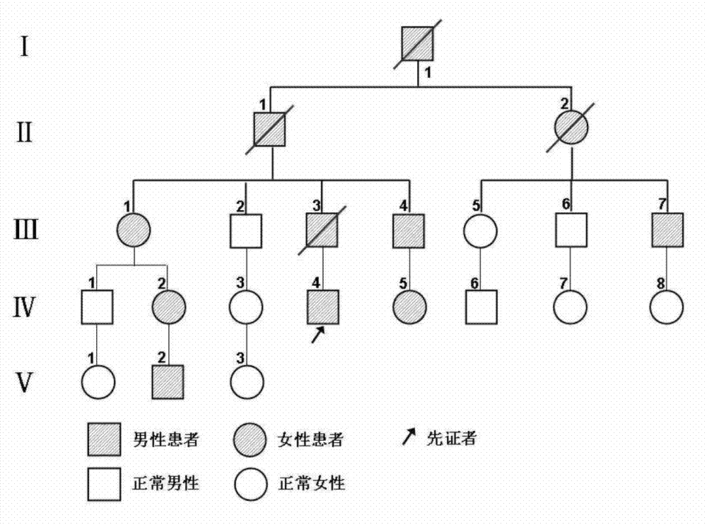 I type neurofibroma NF1 gene mutation nucleotide sequence related to cerebrovascular stenosis and application thereof