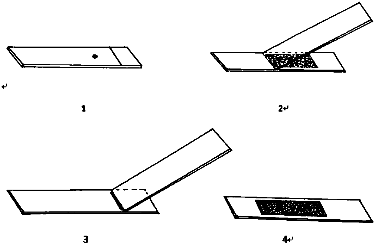 A kit for rapid microscopic examination diagnosis of swine eperythrozoonosis and a preparing method thereof