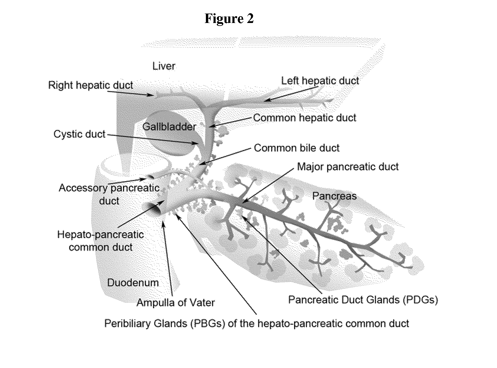 Method of treating pancreatic and liver conditions by endoscopic-mediated (or laparoscopic-mediated) transplantation of stem cells into/onto bile duct walls of particular regions of the biliary tree