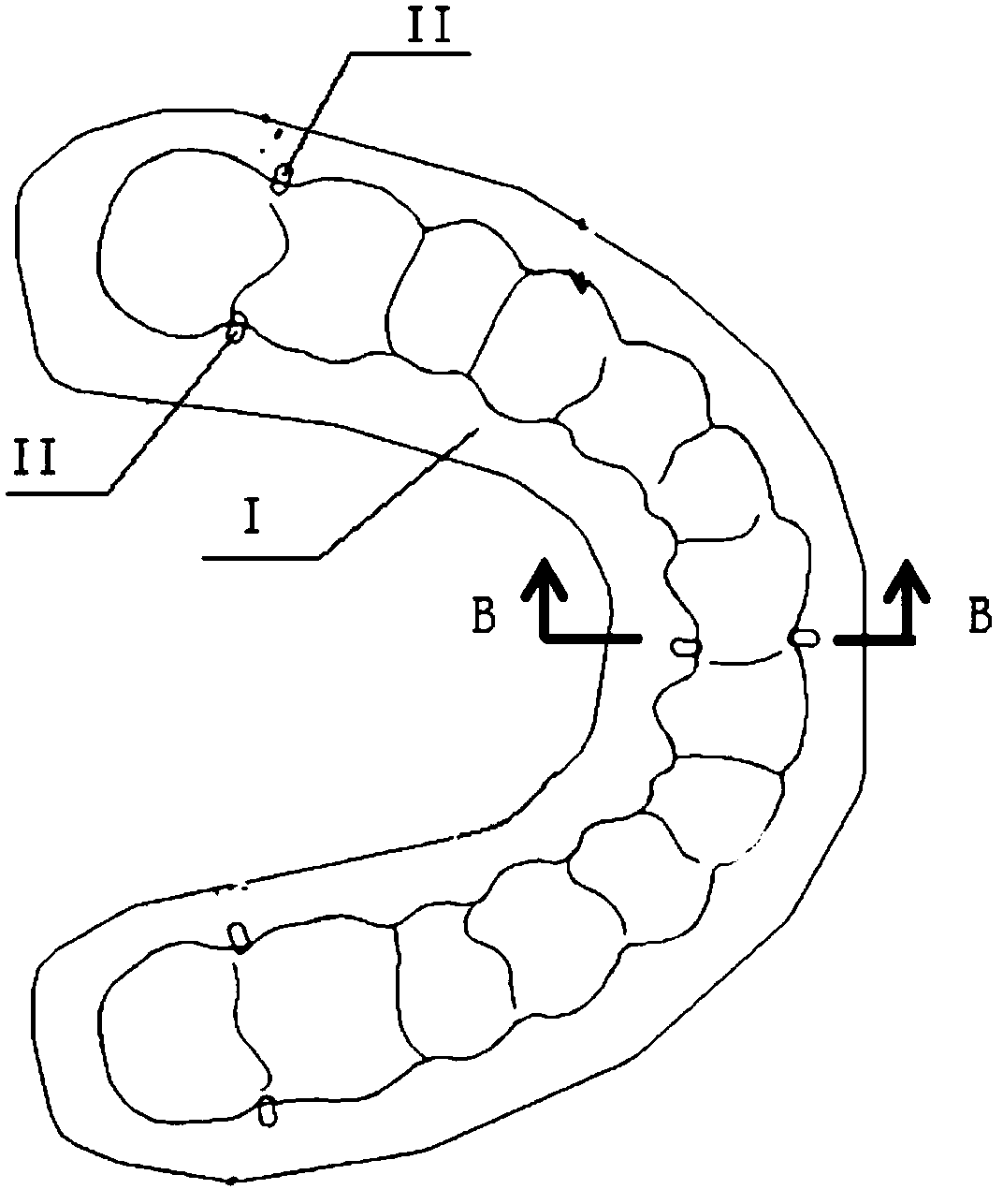 Demolding method of clear aligners without brackets