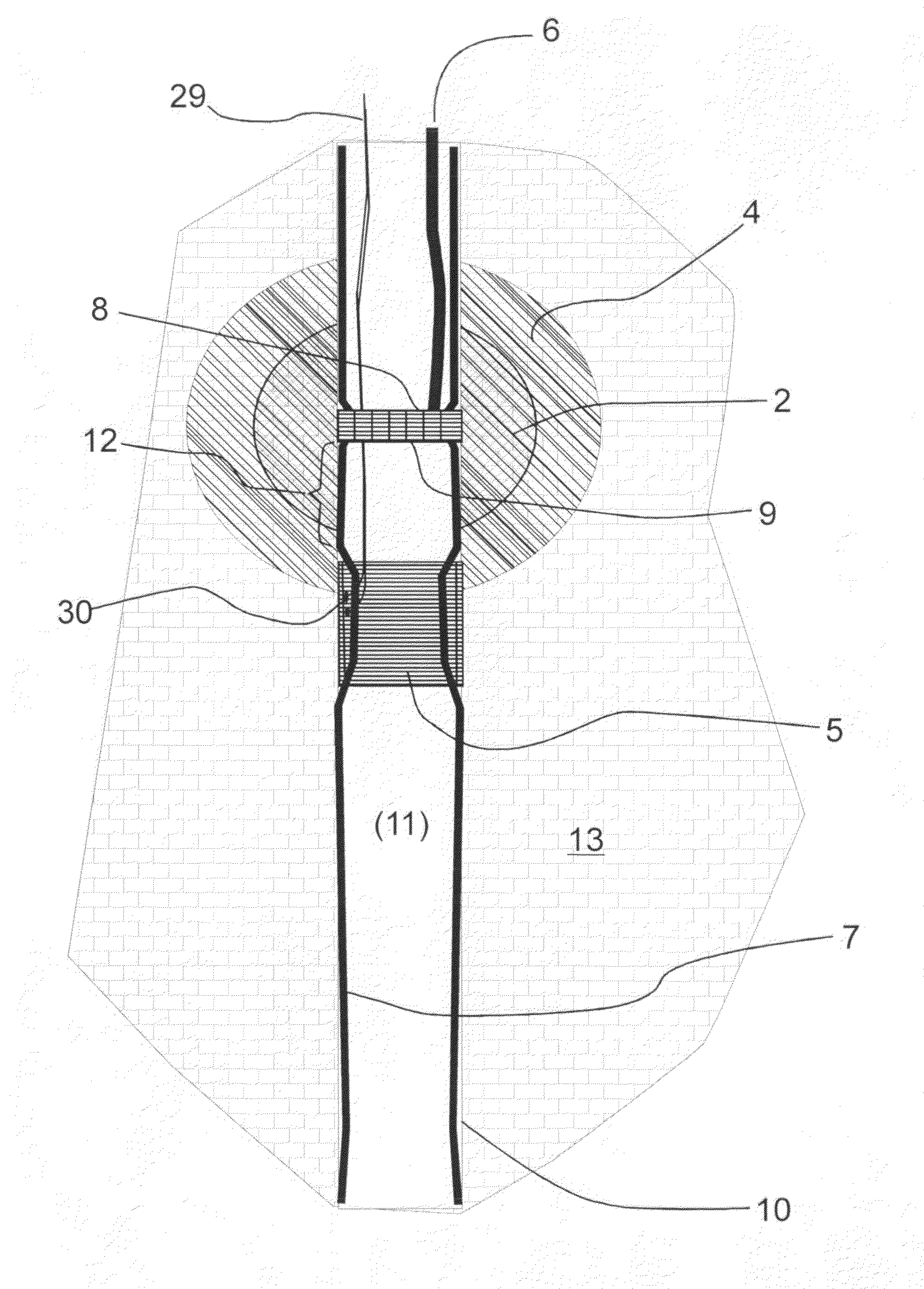 Vadose zone pore liquid sampling system