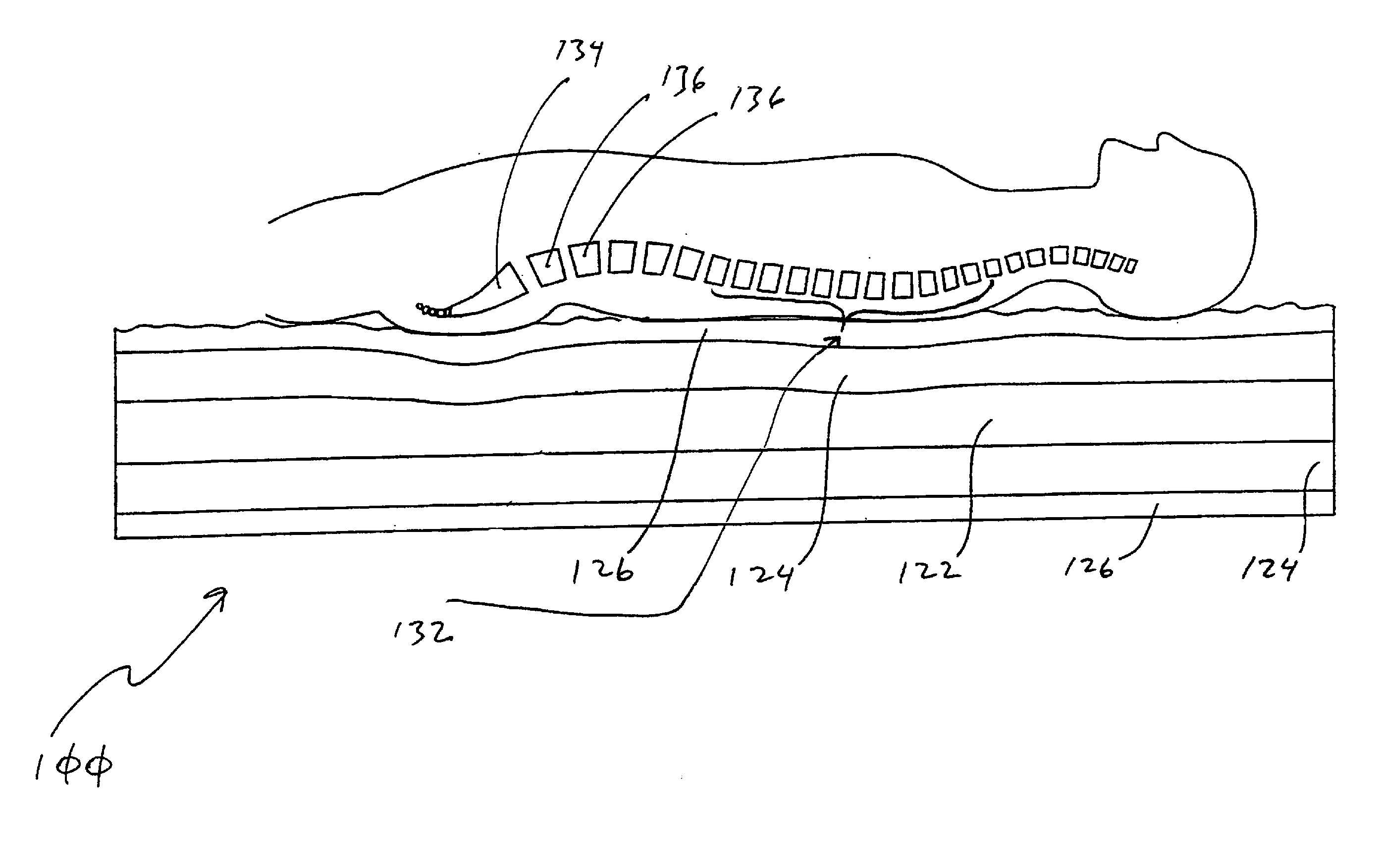 Tension relieving body support apparatus