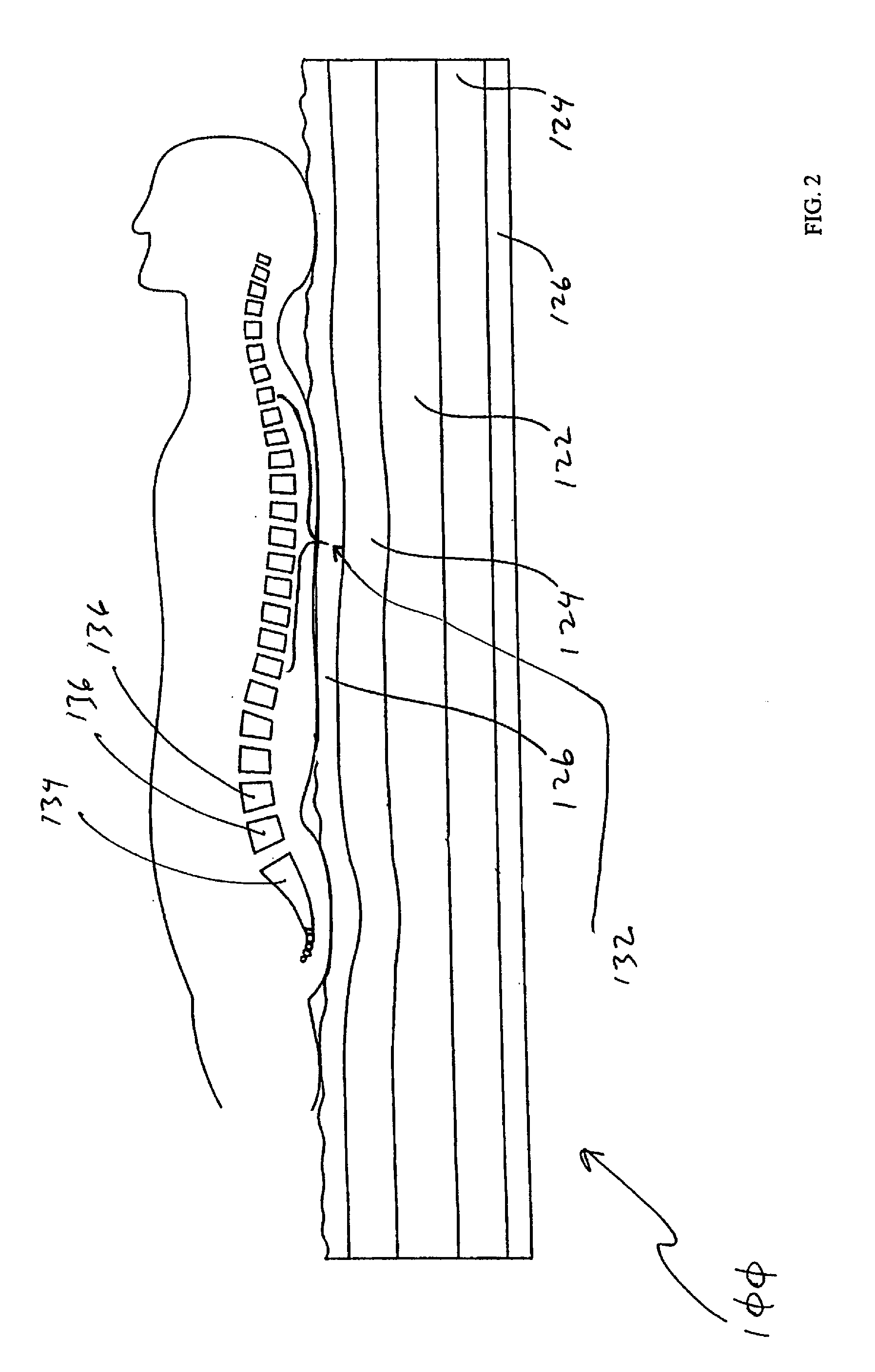 Tension relieving body support apparatus