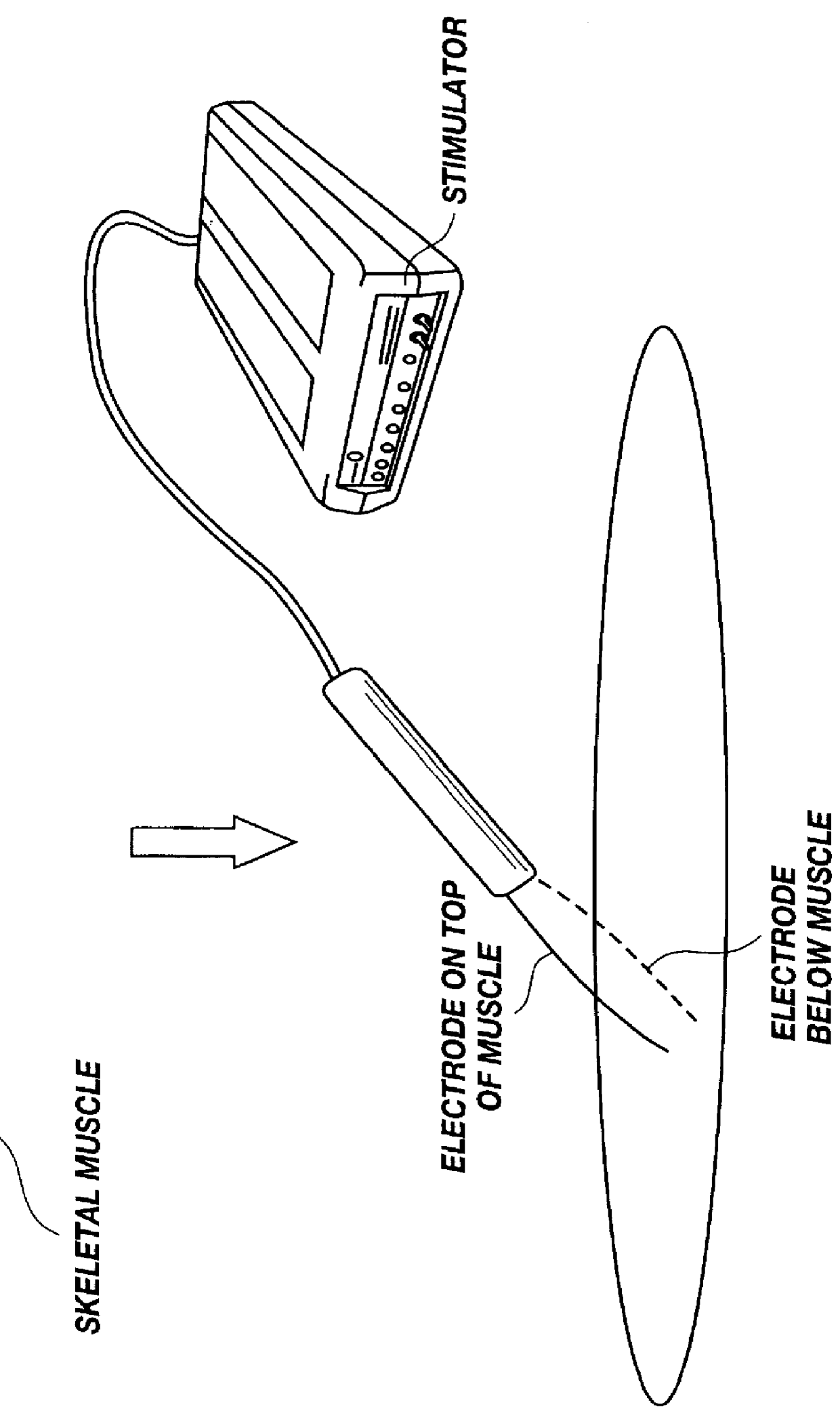 Method for introducing pharmaceutical drugs and nucleic acids into skeletal muscle